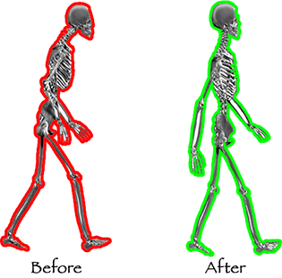 Posture problems? Improve yours by understanding the causes
